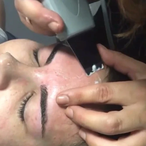 botox capilar