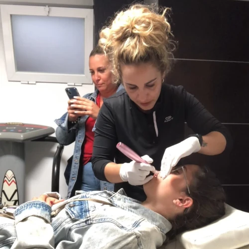 tratamiento con dermapen